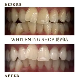 メンズ ホワイトニング ショップ葛西店のその他イメージ