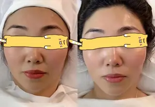 aliaハーブ水光店 エステティシャン募集のエステ・リラクイメージ