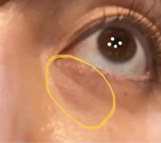 美容鍼専門 ハリエンジュのエステ・リラクイメージ