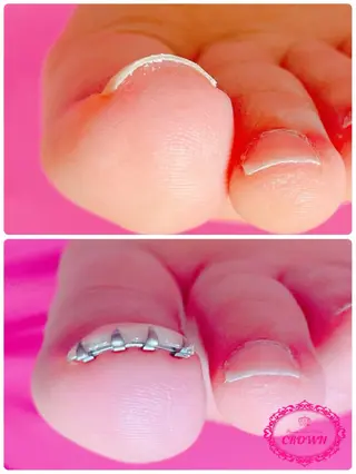 ネイル CROWN プライベートサロンのネイルデザイン