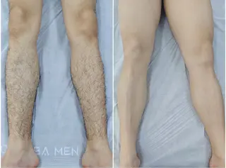 メンズ エルモサ痩身脱毛 西八王子店のエステ・リラクイメージ