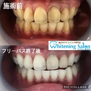 歯科レベルの白さ💎 ✨ホワイトニング豊田のエステ・リラクイメージ
