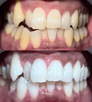 io teeth careのその他イメージ