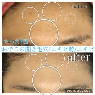 ロング カラー パーマ ヘアアレンジ キッズ ネイル マツエク・マツパ EnsorClair 代表 野口真央のエステ・リラクイメージ