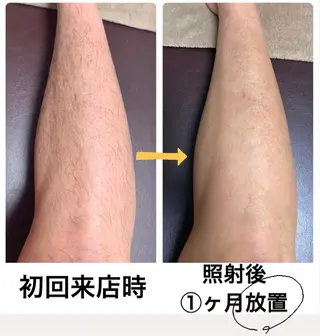 メンズ脱毛サロン Le falcoのエステ・リラクイメージ