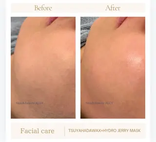 艶肌ワックス ALLY.のエステ・リラクイメージ