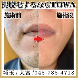 脱毛 TOWA大宮のエステ・リラクイメージ