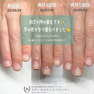 ネイル 自爪育成専門サロン ◌𓈒azumiのネイルデザイン