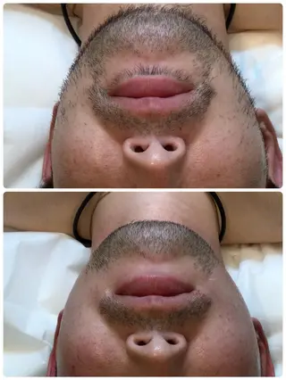 メンズ Mei シュガーリストのエステ・リラクイメージ