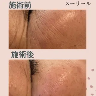 肌荒れに悩む方のため オイルフリーサロンのマツエク・マツパデザイン