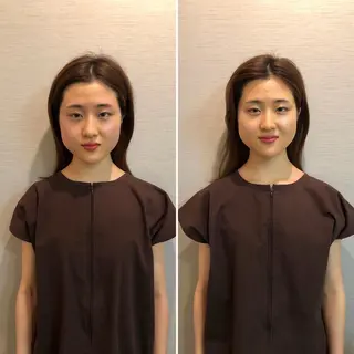 即小顔♥️美容鍼× ハーブピーリングのその他イメージ
