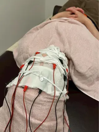 美容鍼灸Solana所属・肌質改善×美容鍼 ゆいのエステ・リラクイメージ