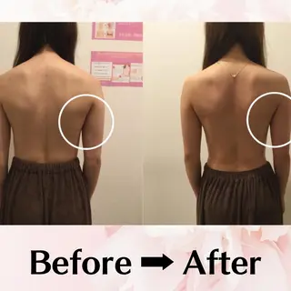 バスト・脱毛・痩身 上島のエステ・リラクイメージ