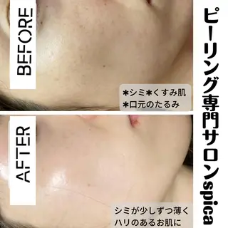 ピーリング専門サロン Spicaのエステ・リラクイメージ