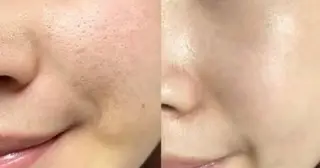 エステサロン lindyのエステ・リラクイメージ