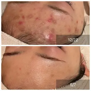 CHERIE Hisadaのエステ・リラクイメージ