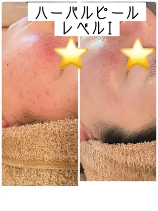 エステティック sala藤沢のエステ・リラクイメージ