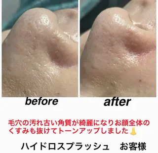 ネイル・エステサロン UILANIのネイルデザイン