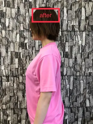 特別クーポン配布中 美容鍼・整体お得に！のその他イメージ