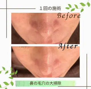 ニキビ改善サロン 縁樹 enju所属・ニキビ専門サロン縁樹 鈴木真樹のエステ・リラクイメージ