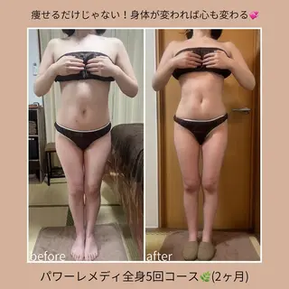 《本気痩せ×疲労改善 》  BILOOPのエステ・リラクイメージ