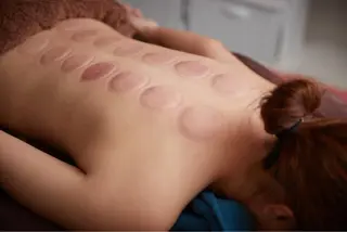 美楽鍼 びらくしんのその他イメージ