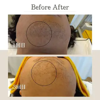 メンズ EDEL エーデルのエステ・リラクイメージ