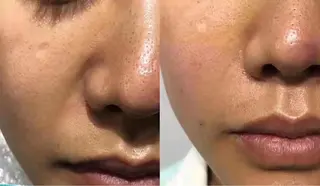 aliaハーブ水光店 エステティシャン募集のエステ・リラクイメージ