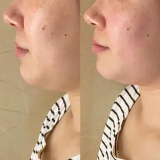 MAREA 小顔SALONのエステ・リラクイメージ