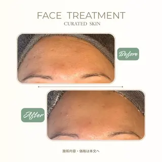 CURATED SKIN｜神戸三宮のエステ・リラクイメージ