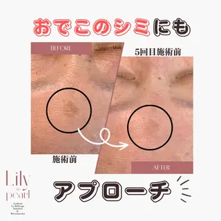 最新シミケアLily de pearlのエステ・リラクイメージ