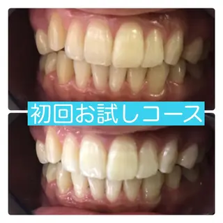 ホワイトニングルーム 横浜店のその他イメージ