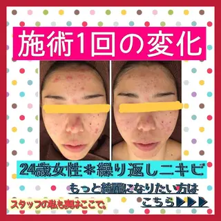 ショート カラー パーマ ヘアアレンジ メンズ キッズ ネイル マツエク・マツパ ニキビ・肌質改善専門 ♡人生が変わるサロンのエステ・リラクイメージ