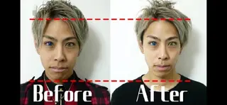 メンズ 医療提携Ruby小顔 ハーブピーリングのその他イメージ