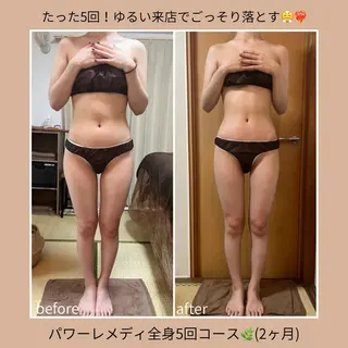 《本気痩せ×疲労改善 》  BILOOPのエステ・リラクイメージ