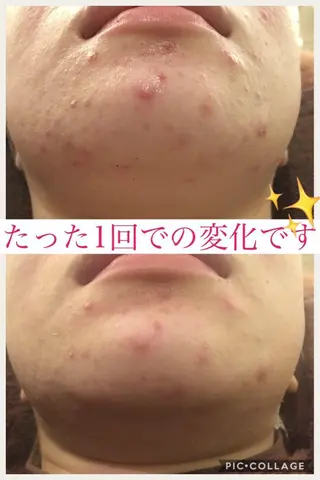 ミディアム カラー パーマ ヘアアレンジ メンズ キッズ ネイル マツエク・マツパ ニキビ・肌質改善専門 ♡人生が変わるサロンのエステ・リラクイメージ