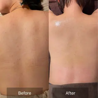 for woman所属・森 美優のエステ・リラクイメージ