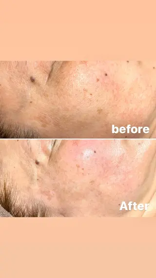 アヴニール プライベートサロンのその他イメージ