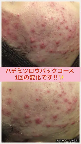 ミディアム カラー パーマ ヘアアレンジ メンズ キッズ ネイル マツエク・マツパ ニキビ・肌質改善専門 ♡人生が変わるサロンのエステ・リラクイメージ