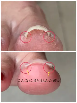 メンズ ネイル Chérinail 爪のお手入れのネイルデザイン