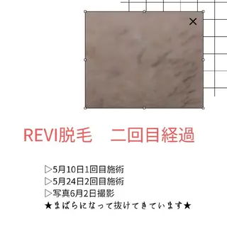 Luanaまつパ脱毛 ハーブピーリング眉毛のマツエク・マツパデザイン