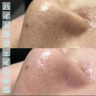 Lilyboo 多田のエステ・リラクイメージ