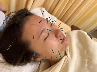 鍼灸サロン BBB3のその他イメージ