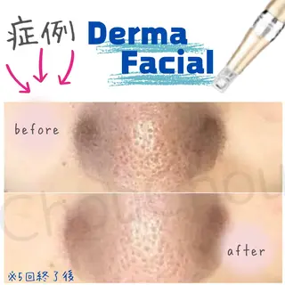 肌質改善サロン chouchouのエステ・リラクイメージ