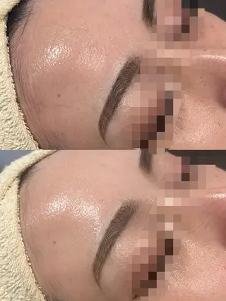 ホワイトラボ梅田 ｜毛穴・韓国肌管理のエステ・リラクイメージ