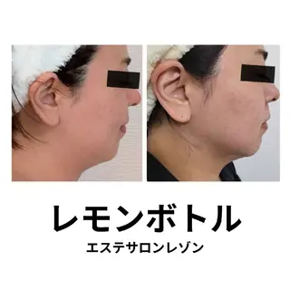 〈ニキビケアサロン〉 レゾン京橋店/ 浅川のエステ・リラクイメージ