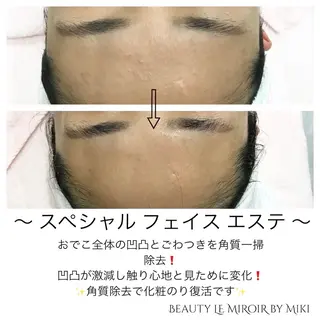 ビューティー ミロワールのエステ・リラクイメージ