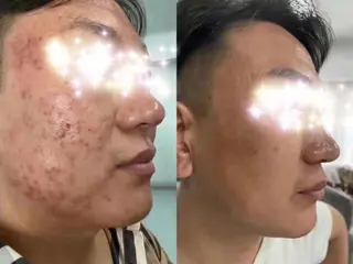 肌質改善サロン★ リュー・ド・ボウテのエステ・リラクイメージ