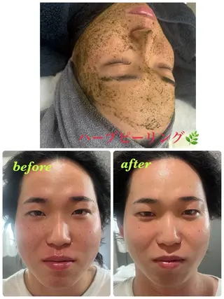 ハーブピーリング専門 毛穴洗浄❤️眉waxのエステ・リラクイメージ