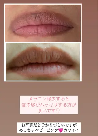 Raviy 【痩身専門・肌管理】のエステ・リラクイメージ